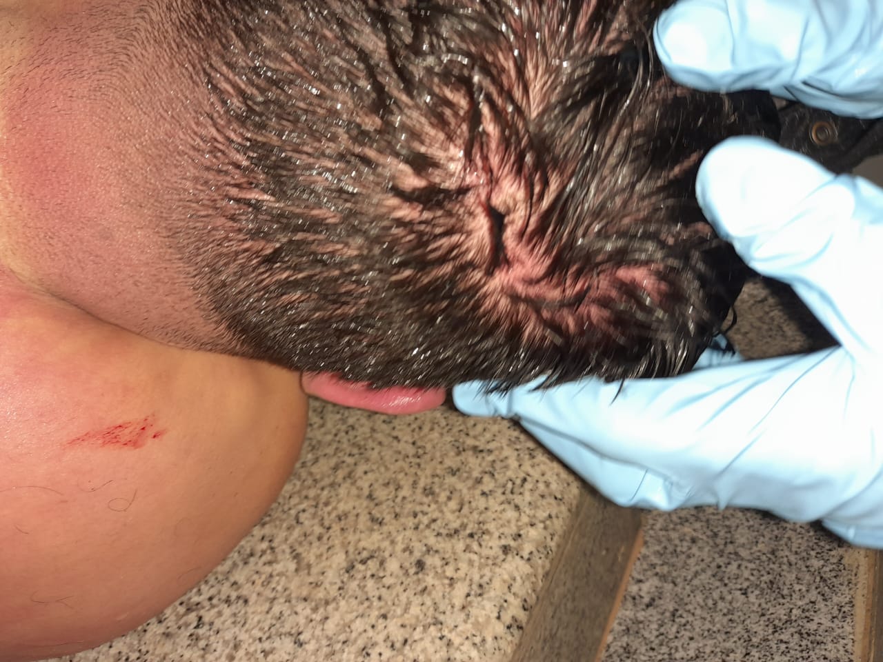 يُفيد تقرير الطبيب الشرعي الياس الخوري أن سبب وفاة حرقوص “يعود لتعرّضه صدمًا وإيذاءً بأجسام صلبة غير حادة خاصة عند الجمجمة نتج عن كل ذلك نزيف دماغي قوي وآني مع تورّم مائي شامل من شأنهما علو الضغط بداخل دماغه وبالتالي تعطيل وظائفه بما فيها عمل رئتيه وقلبه وبالتالي وفاته